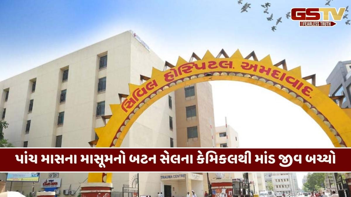 Ahmedabad/ 5 મહિનાના બાળકે ગળી લીધો બટન સેલ, સિવિલના ડૉક્ટરોએ બચાવ્યો જીવ