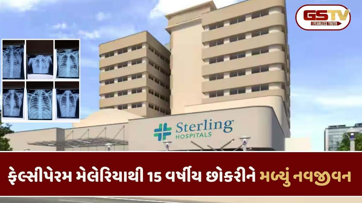 Ahmedabad news: સ્ટર્લિંગ હોસ્પિટલ્સમાં ફેલ્સીપેરમ મેલેરિયાથી મલ્ટિપલ ઓર્ગન ડેમેજ બાદ એડવાન્સ ટ્રિટમેન્ટ મળતા 15 વર્ષની છોકરીનો  જીવ બચ્યો