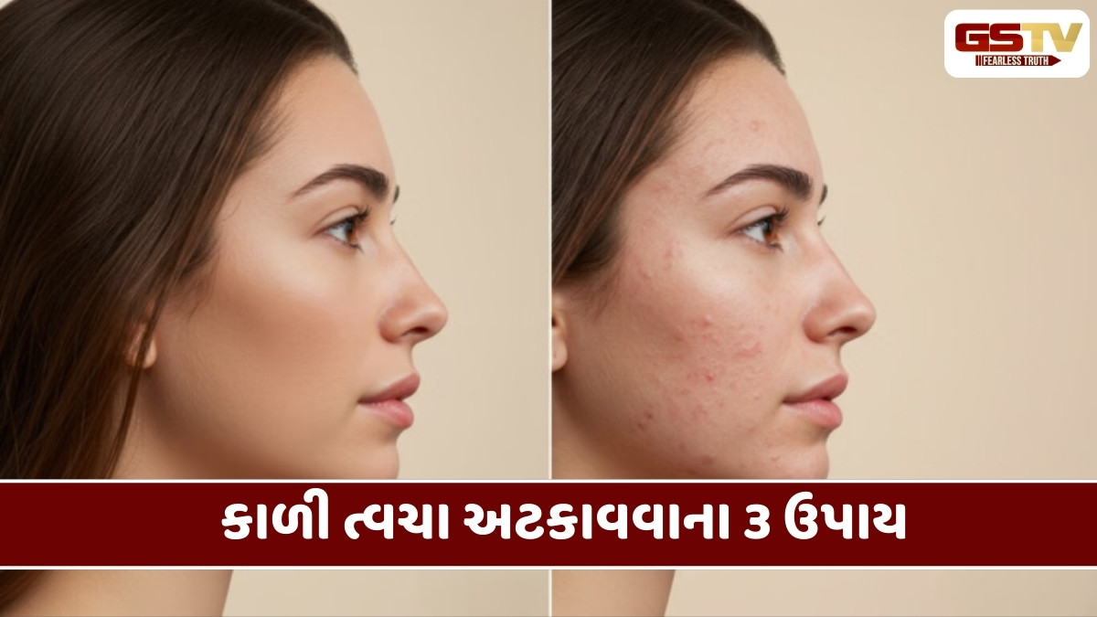 Beauty Tips: શું શિયાળામાં તમારો ચહેરો કાળો પડી જાય છે? જાણો કારણો અને સરળ ઉપાય