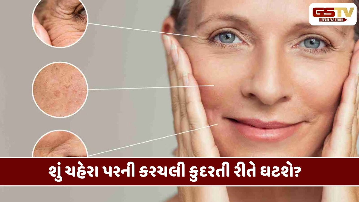 Beauty Tips : શું ચહેરાની કરચલીઓ કુદરતી રીતે ઓછી થઈ શકે છે?