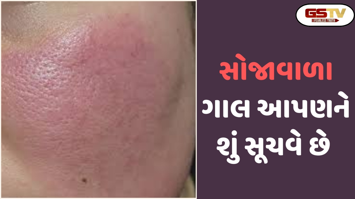 Religion: સોજાવાળા અને લાલ ગાલ શું સૂચવે છે? જાણો સામુદ્રિક શાસ્ત્ર શું કહે છે