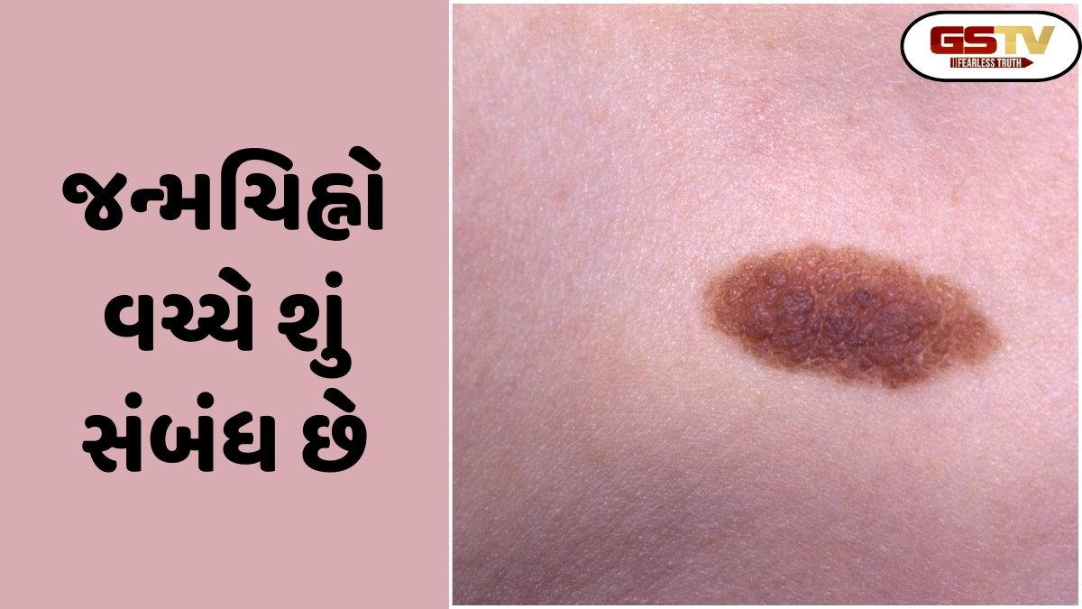 Religion: શરીર પર જન્મચિહ્નો અને ભૂતકાળના જન્મ વચ્ચે શું સંબંધ છે? જાણો શું છે આખી વાત