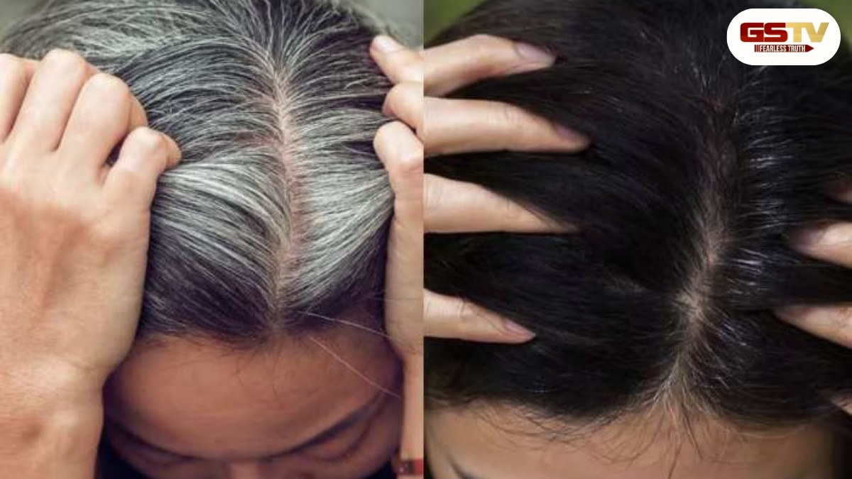 Hair Care Tips : આ 5 વસ્તુના ઉપાયથી સફેદ વાળ મૂળથી થશે કાળા, બસ આ રીતે કરો ઉપયોગ