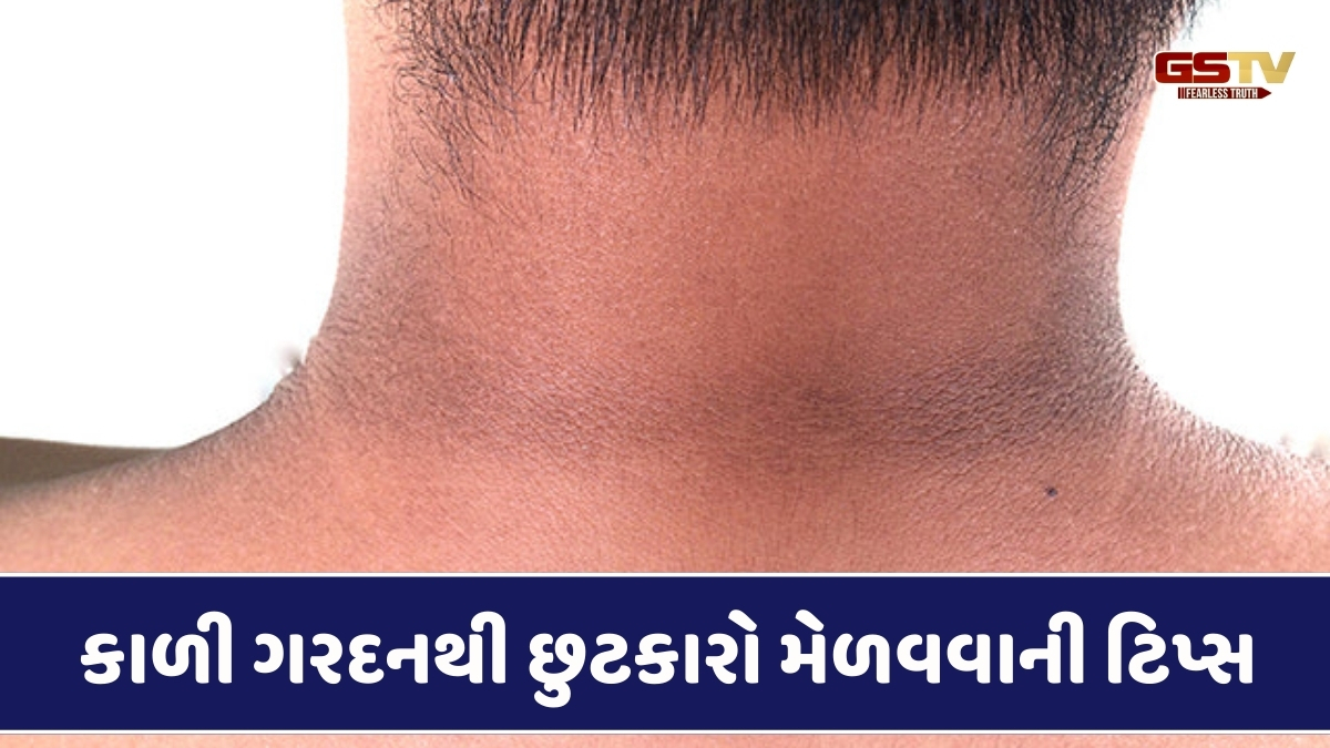 Beauty Tips : કાળી ગરદન પળવારમાં સાફ થઈ જશે, ઘરે જ કરો આ 5 ઉપાય