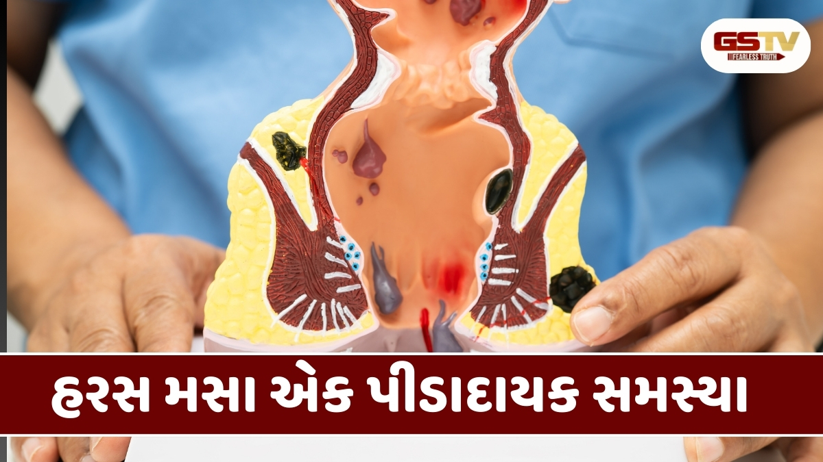 Health Tips : આ 6 ખોરાક હરસના દર્દીઓ માટે ખતરનાક, સેવન ન કરશો તો ટોઇલેટમાં પાડશો ચીસો 