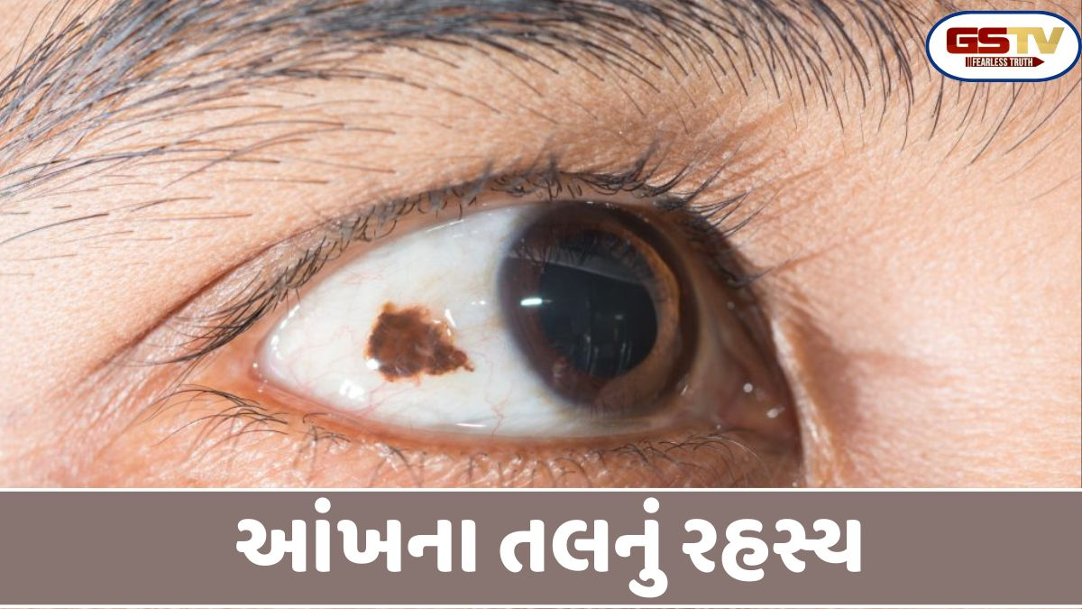 Religion : આંખમાં તલ હોવા પાછળ છુપાયેલા છે ભવિષ્યના આ મોટા સંકેતો