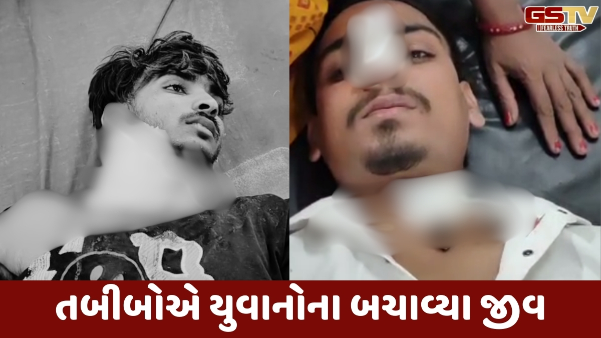 Panchmahal news: ચાઈનીઝ દોરીથી 4 યુવાનો ગંભીર રીતે  ઈજાગ્રસ્ત, બે લોકોના ગળા કપાતા તબીબોએ બચાવ્યો જીવ