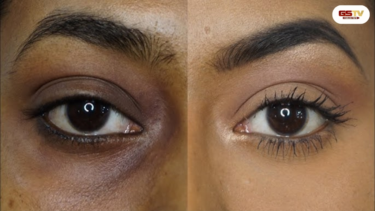 Beauty Tips: શું ફોનને જોવાથી ડાર્ક સર્કલ થાય છે? જાણો સત્ય અને તેનાથી મેળવો છુટકારો