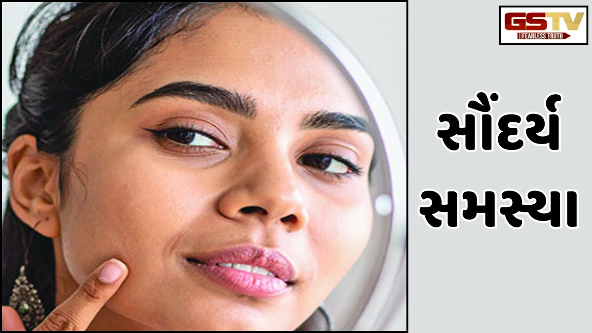 Sahiyar : ડેટોલથી  સાફ કર્યા બાદ મારા ચહેરા પર કાળા ધાબા પડી ગયા છે