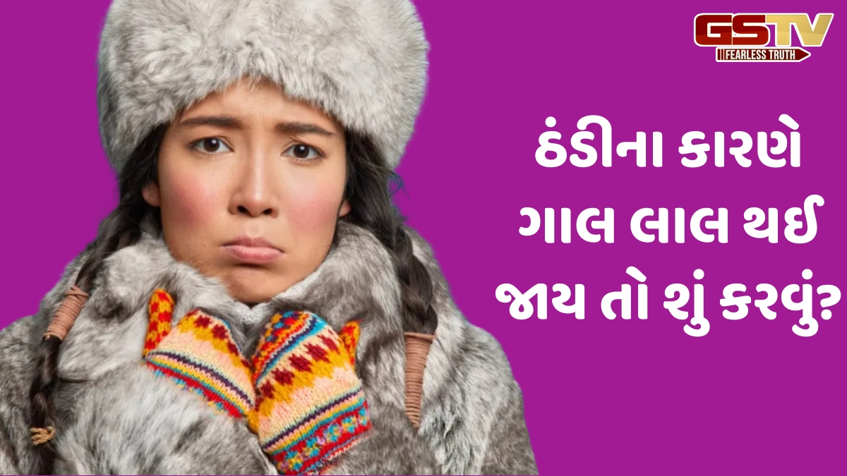 શિયાળામાં ગાલ લાલ થઈ જાય અને બળતરા થાય તો શું કરવું? આ વસ્તુઓ લગાવવાથી મળશે રાહત