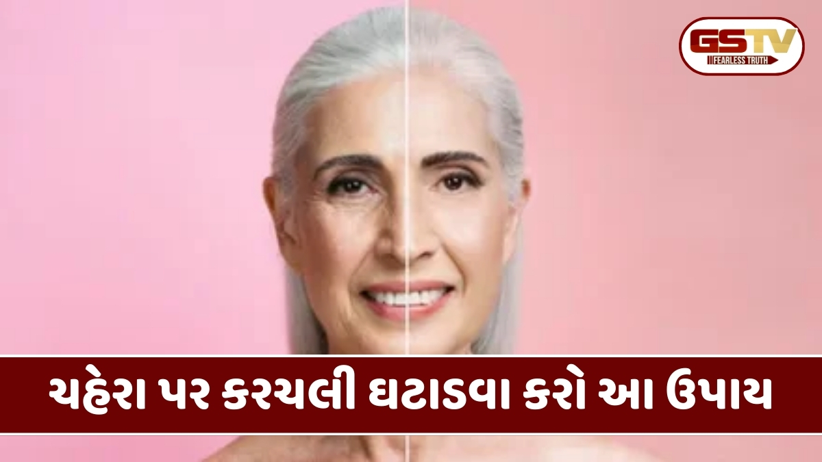 Beauty tips: નાની ઉંમરમાં જ ચહેરા પર કરચલી પડી રહી છે તો જરૂર અપનાવો આ ઉપાય 