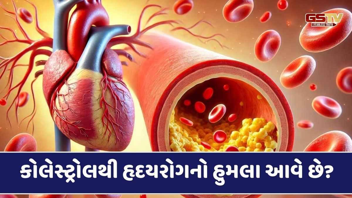 Health Tips : કોલેસ્ટ્રોલના દર્દીઓને હાર્ટ એટેકનું જોખમ કેટલું હોય છે? જાણો હૃદય કેવી રીતે રાખવુ હેલ્ધી