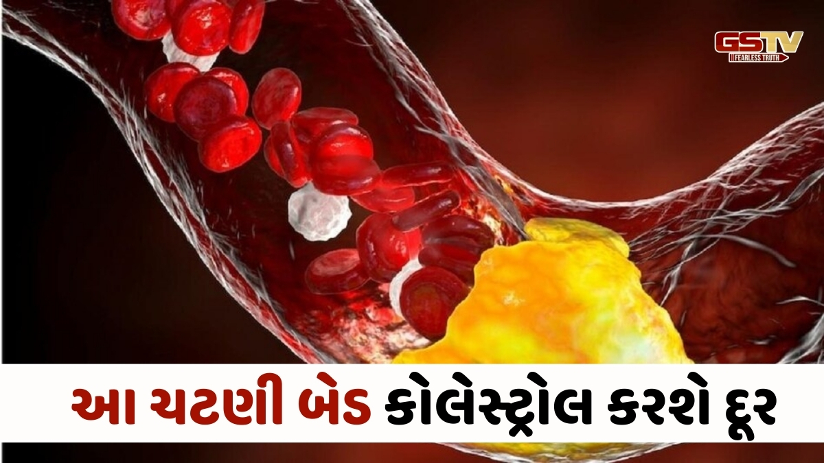 ઘરે તૈયાર કરો આ ચટણી, નસોમાં જામેલું બેડ કોલેસ્ટ્રોલ ફટાફટ થઈ જશે સાફ!