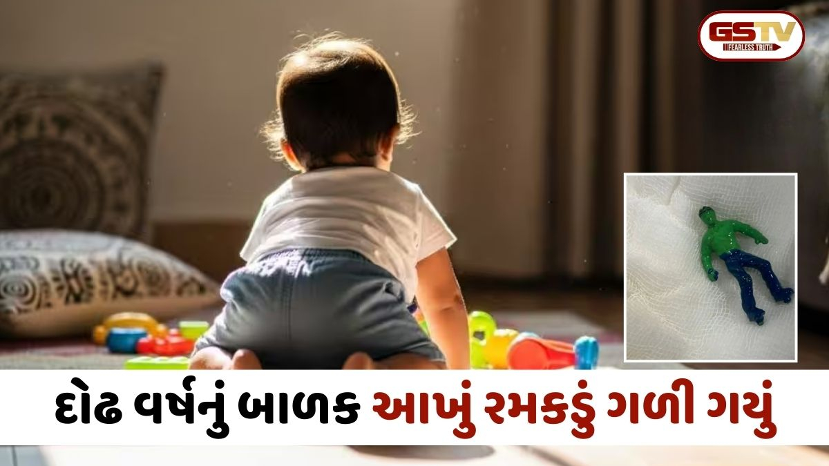 Ahmedabad: દોઢ વર્ષનું બાળક રમતાં-રમતાં આખુ હલ્ક' રમકડું ગળી ગયું, સિવિલ હોસ્પિટલમાં કરાઈ જટિલ સર્જરી
