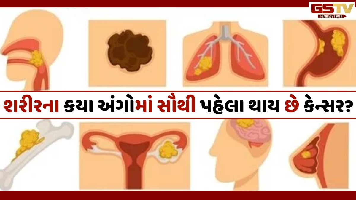 Health: શરીરના આ અંગો પર કેન્સર સૌથી પહેલા કરે છે હુમલો, WHOએ આપી ચેતવણી