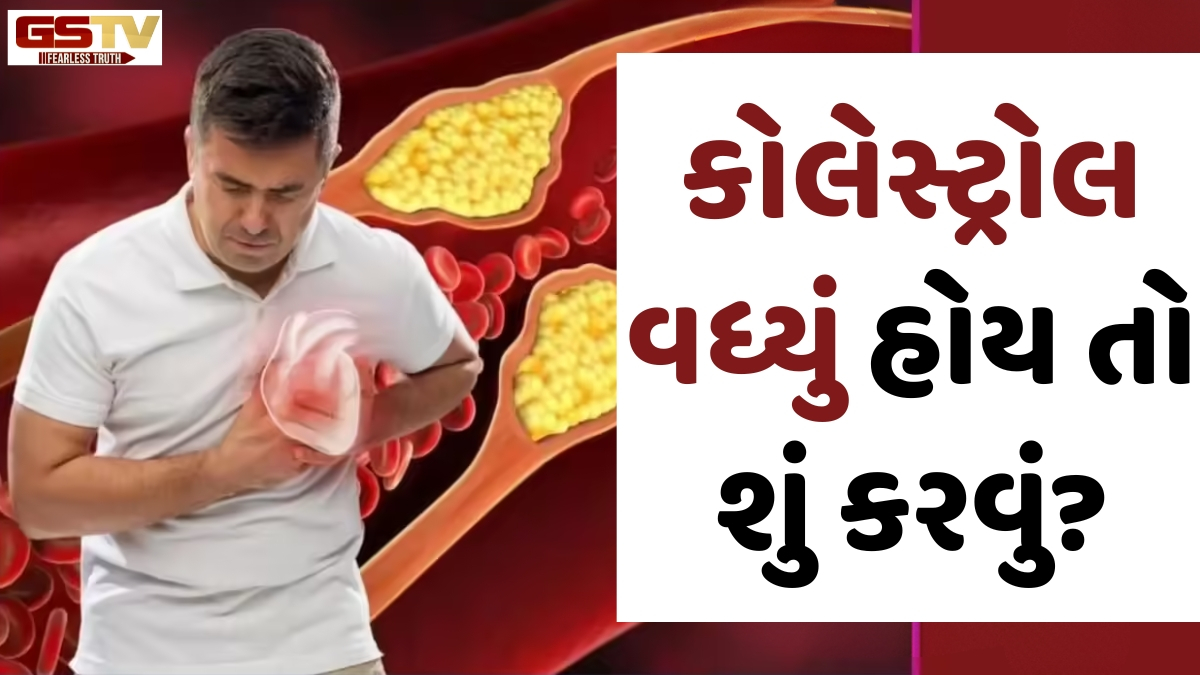 Health: સાવધાન! ફક્ત તેલ જ નહીં, આ એક વસ્તુ ખાવાથી પણ વધે છે કોલેસ્ટ્રોલ