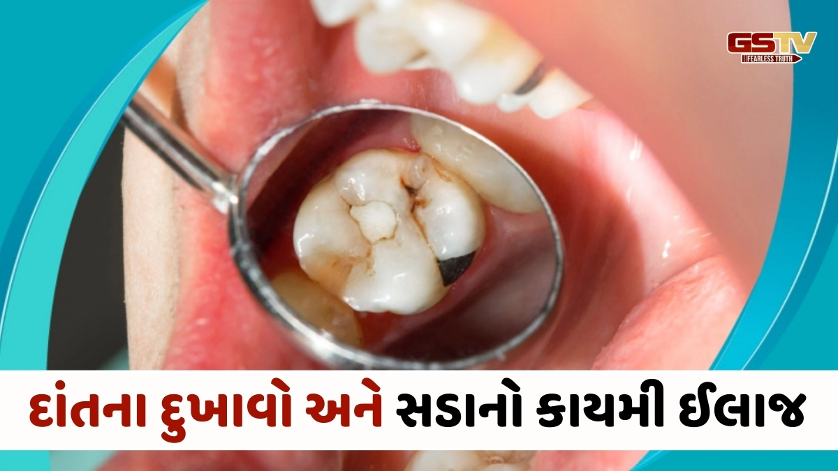 Health Tips: દાંતનો સડો અને દુખાવો જડમૂળથી થશે દૂર! અજમાવો આ 5 રામબાણ ઘરેલુ ઉપાયો