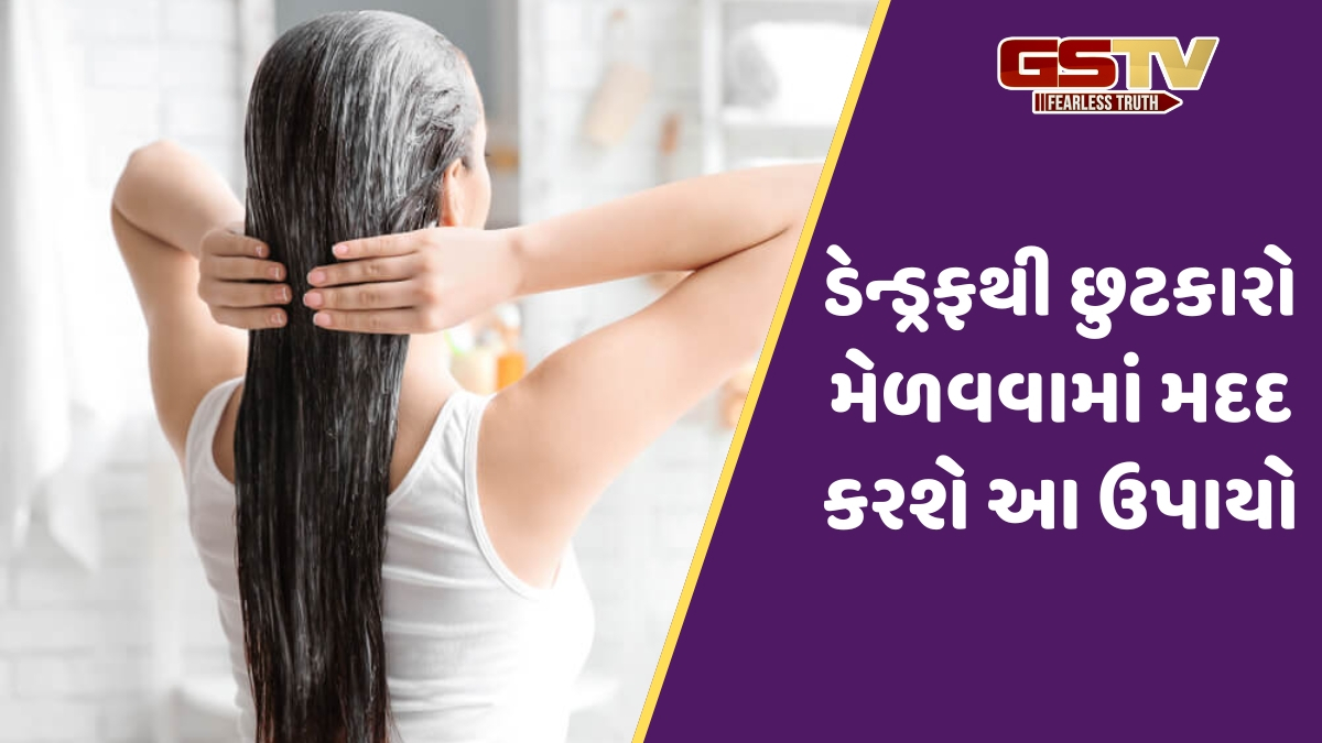 સ્કેલ્પમાં ખંજવાળ અને ડેન્ડ્રફથી પરેશાન છો? તો ટ્રાય કરો દહીંના 3 હેર માસ્ક, થોડા દિવસોમાં દેખાશે અસર!