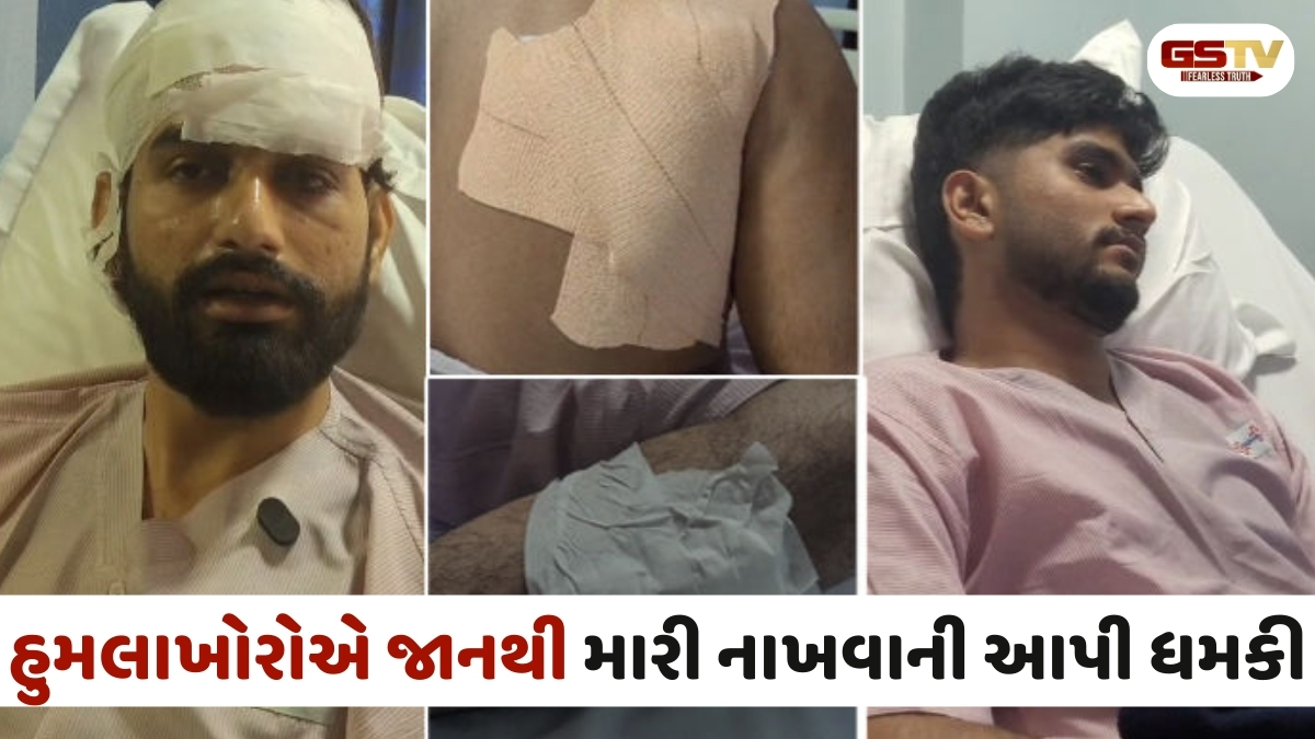 Ahmedabad news: વસ્ત્રાપુરમાં 20 શખ્સોએ સામાન્ય બાબતે બે યુવાનોને માર્યા છરીના ઘા, પોલીસ પેટ્રોલિંગ પર ઉઠ્યા સવાલો
