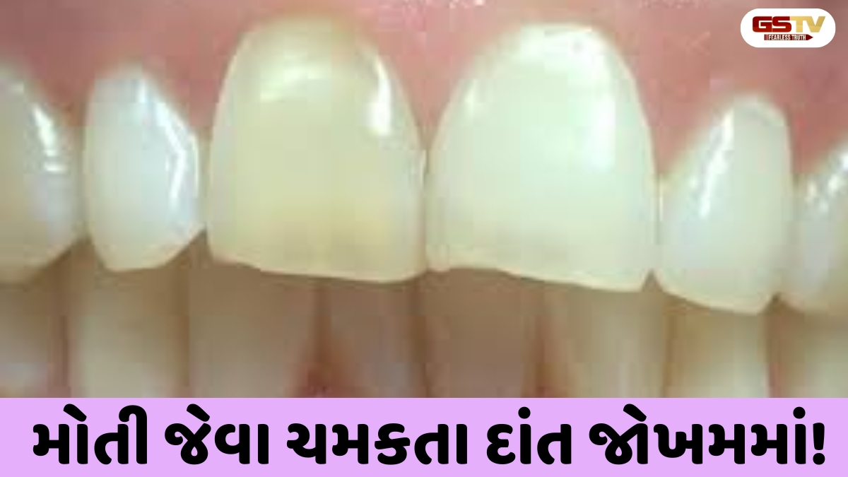 Health Tips:  દાંતની ઉપરની પડ કેમ ઘસાઈ રહી છે? આ 5 ભૂલો આજે જ સુધારો