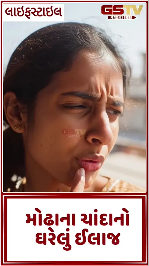 VIDEO : મોઢાના ચાંદાનો ઘરેલું ઈલાજ, ભયાનક દુખાવામાંથી મેળવો મુક્તિ