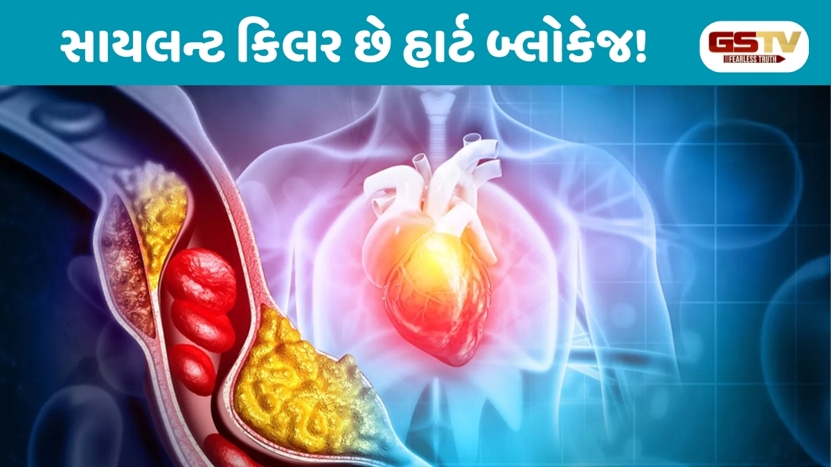 VIDEO : હૃદયની નસો બ્લોક થવાના શરૂઆતી લક્ષણો: સમયસર ઓળખશો તો બચી જશે જીવ!