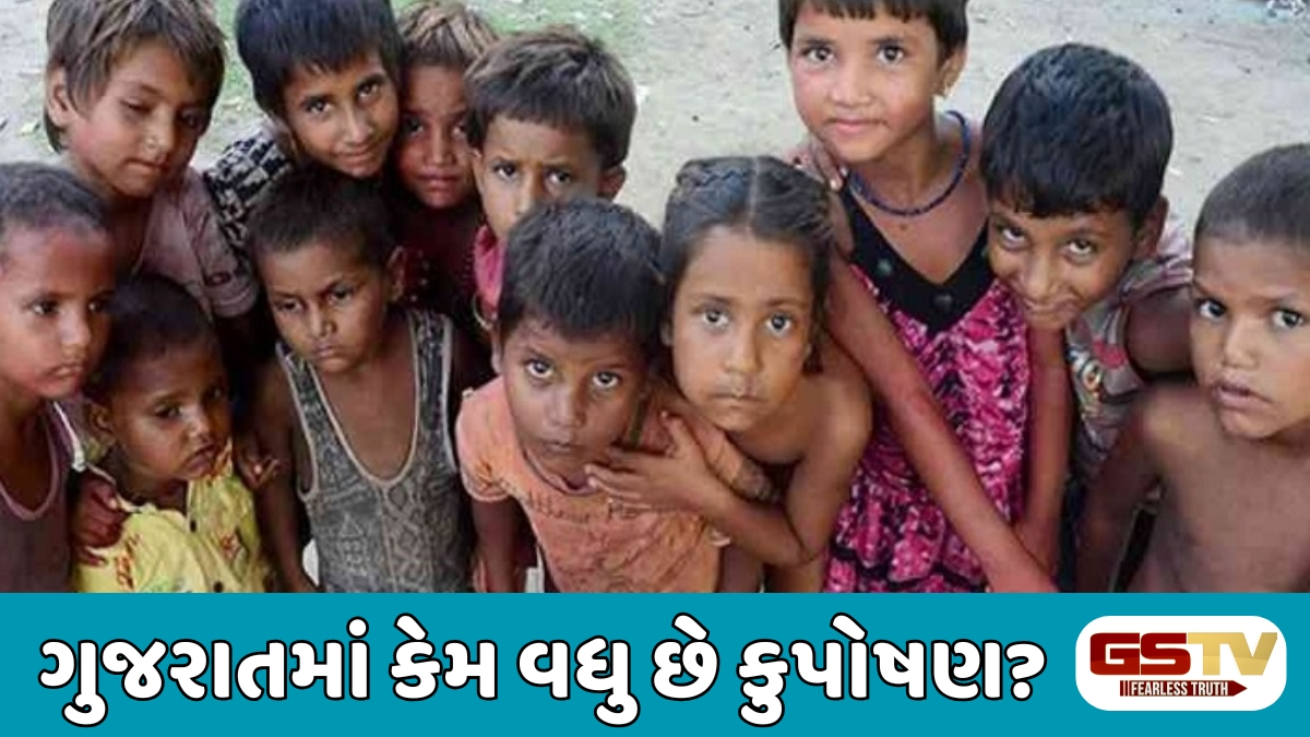 VIDEO : વિકાસની હરણફાળ છતાં ગુજરાતમાં કુપોષણ કેમ? જાણો આંકડા પાછળની વરવી વાસ્તવિકતા