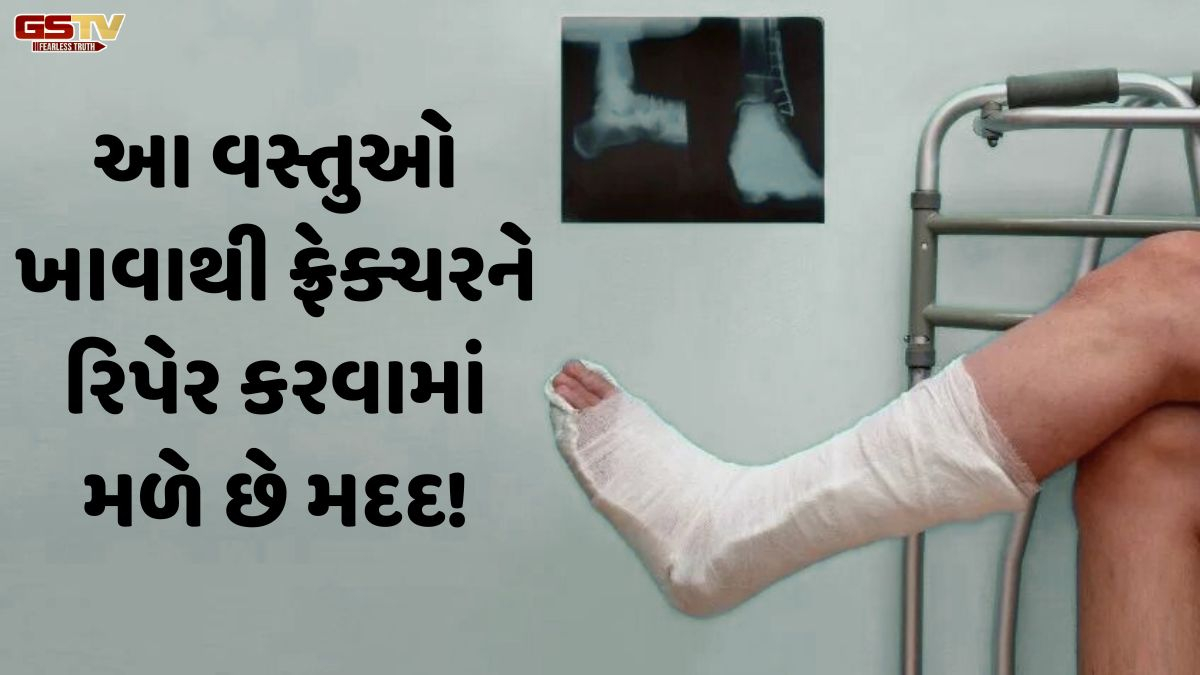 Sahiyar: શું ખરેખર ફ્રેક્ચર થયેલા હાડકાંને નેચરલી રિપેર કરી શકાય? જાણો આ વસ્તુઓ ખાવાથી મળે છે મદદ