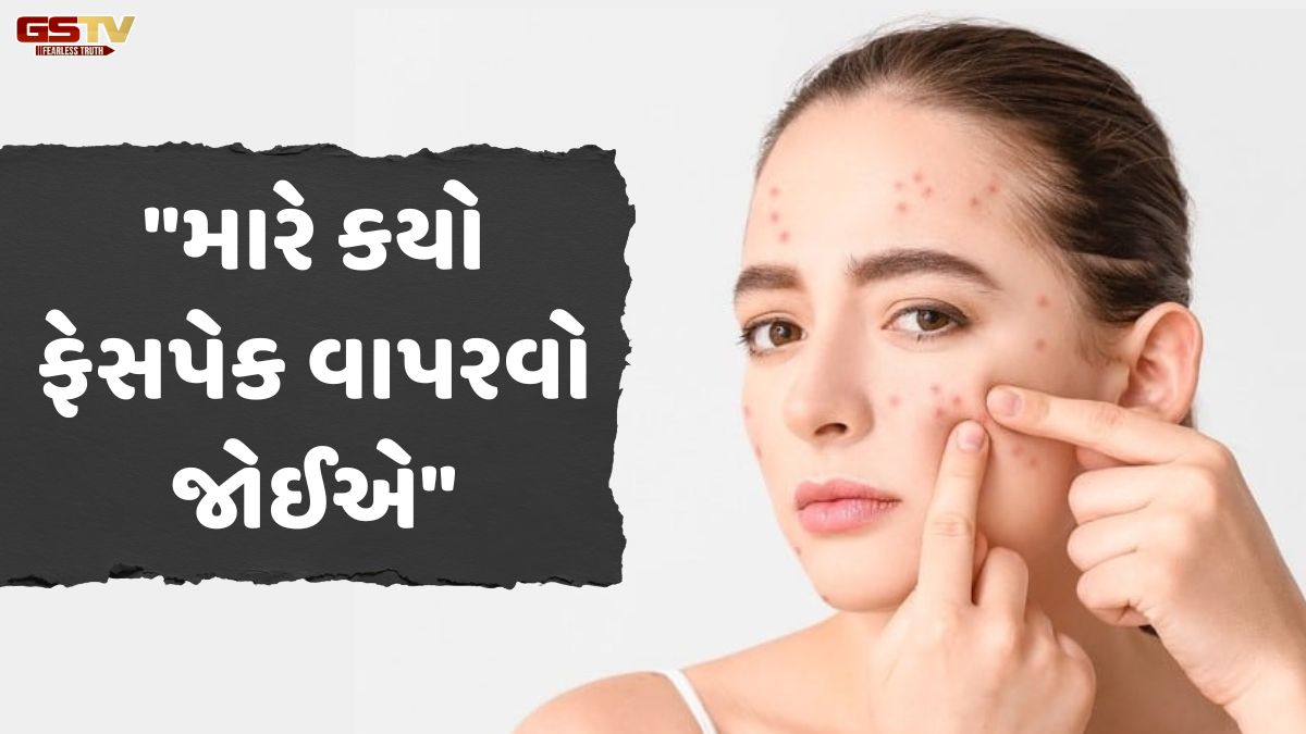 Sahiyar: સૌંદર્ય સમસ્યા/ "મને ખીલની સમસ્યા છે, મારે મારી ત્વચા માટે શું કરવું જોઈએ?"