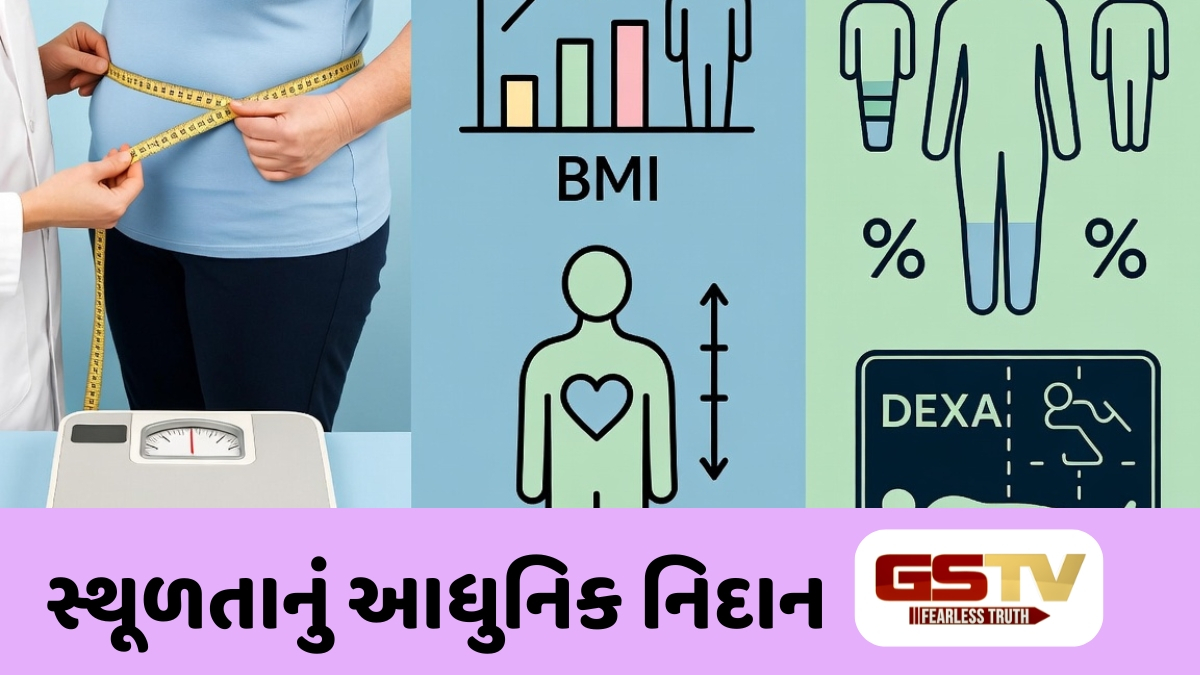 Sahiyar : સ્થૂળતાનું સચોટ નિદાન: વજન અને ઊંચાઈ સિવાય પણ આ બાબતો છે અત્યંત જરૂરી