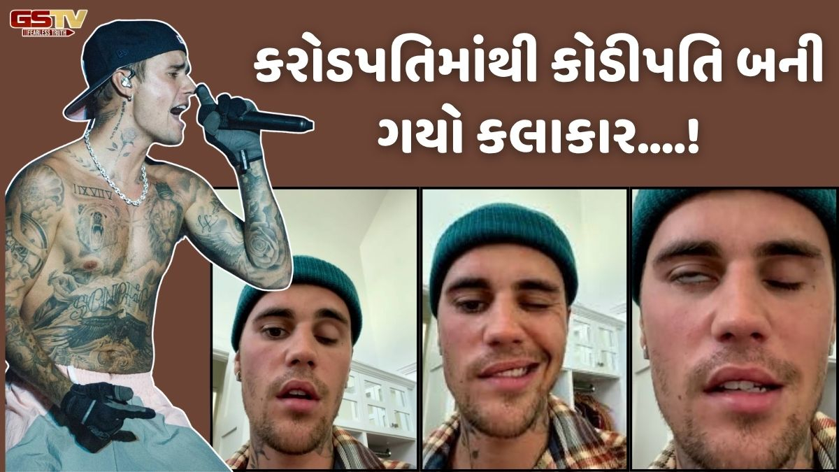 Shatdal: લોકપ્રિય સંગીતકાર જસ્ટિન બીબરને આવ્યો હતો મગજની બીમારીનો એટેક!