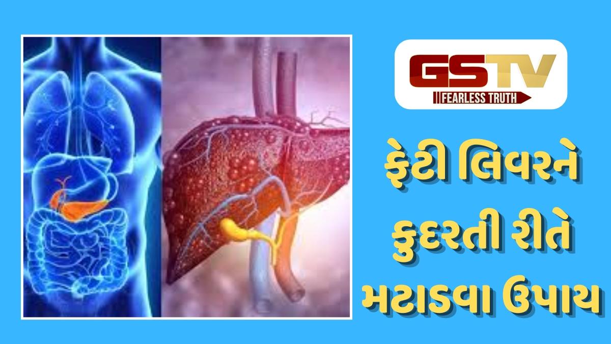 VIDEO : લિવરમાં જમા થયેલી ચરબી ઓગળવા લાગશે મીણની જેમ! આજથી જ અપનાવો આ ફેરફાર