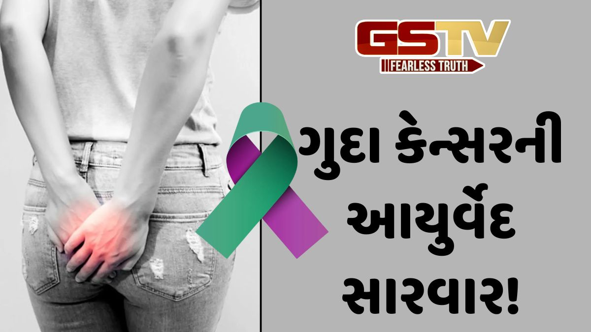 Sahiyar: પુરુષો કરતાં સ્ત્રીઓમાં ગુદાના કેન્સરનું પ્રમાણ વધારે! જાણો, તેની આયુર્વેદ સારવાર