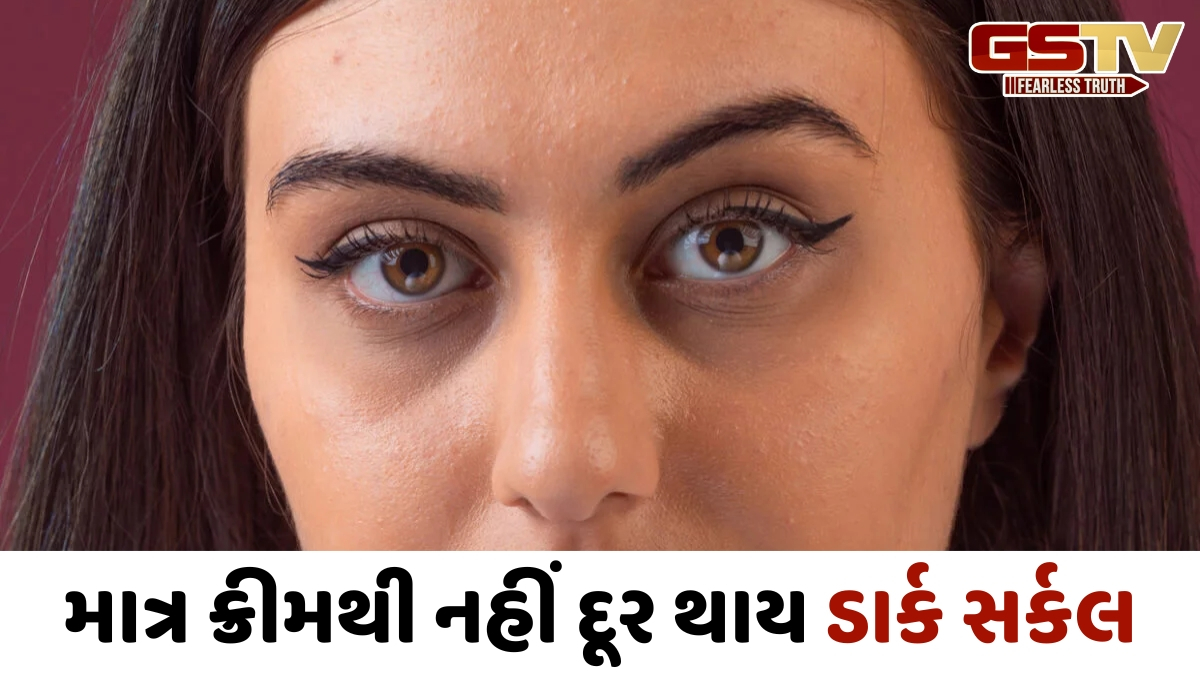 VIDEO: આંખો નીચે ડાર્ક સર્કલ છે? તો ક્રીમ કે ઘરેલું ઉપાયોથી જ નહીં થાય દૂર; આ બાબતોનું પણ રાખો ધ્યાન