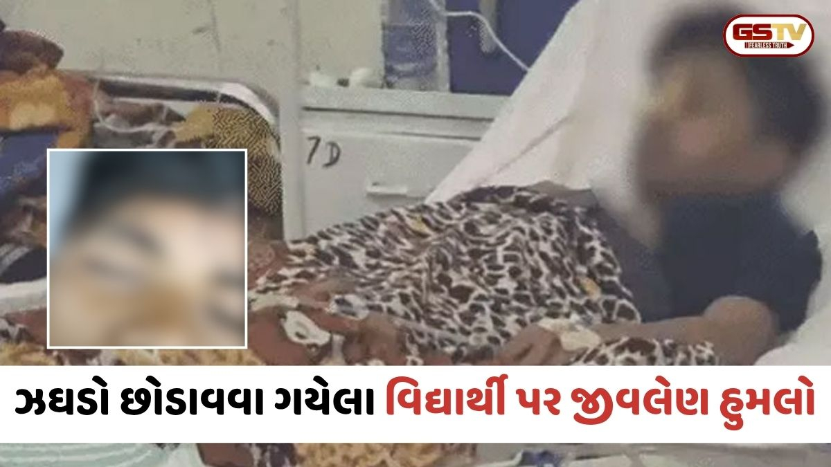Ahmedabad: ઈસનપુર પબ્લિક સ્કૂલની ઘટના; મિત્રનો ઝઘડો શાંત પાડવા ગયેલા ધોરણ 8ના વિદ્યાર્થીની આંખમાં પરિકર ઘૂસાડ્યું