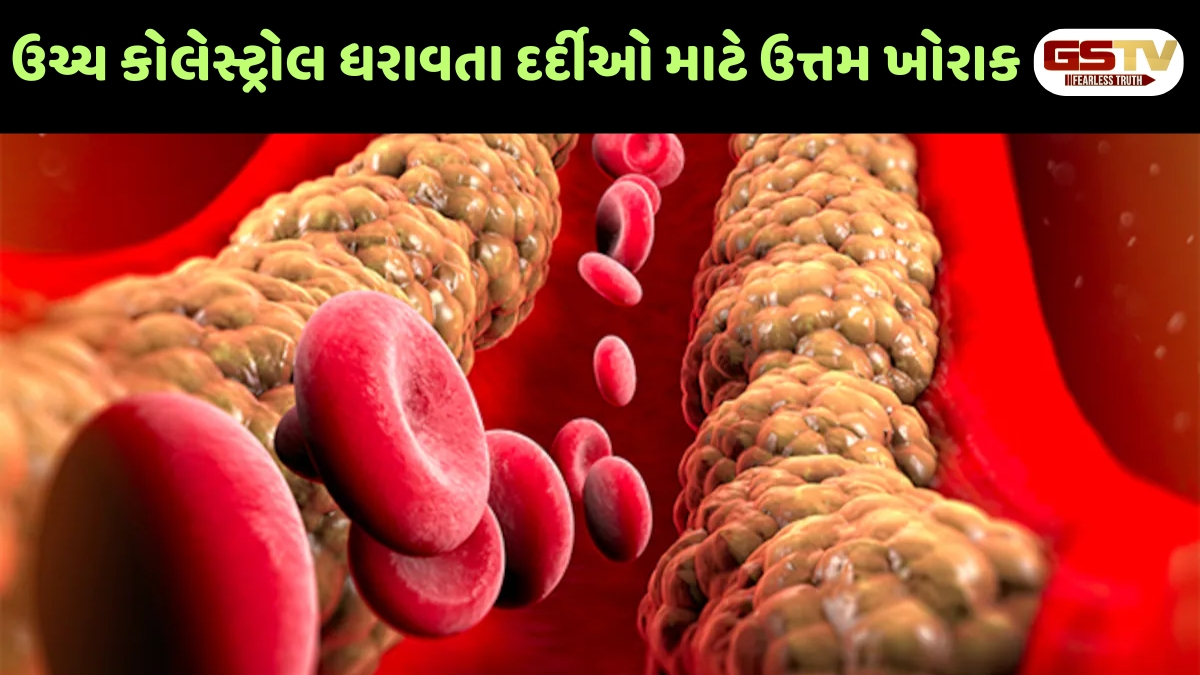 Health Tips : હાર્ટ એટેકનો ખતરો ટાળવો છે? કોલેસ્ટ્રોલ કંટ્રોલ કરવા માટે આજથી જ ડાયટમાં કરો આ ફેરફાર