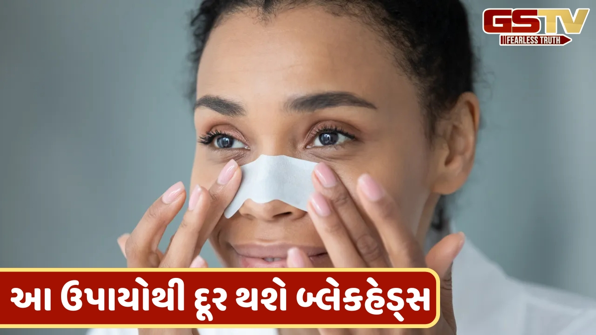 VIDEO: બ્લેકહેડ્સ દૂર કરવાની અસરકારક રીતો, પોર્સમાંથી દૂર થઈ જશે ગંદકી; ચહેરા પર આવશે ચમક