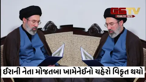 VIDEO/ પગ કપાયો અને ચહેરો સળગ્યો: ગંભીર રીતે ઘાયલ મોજતબા ખામેનેઈની થઈ શકે છે પ્લાસ્ટિક સર્જરી