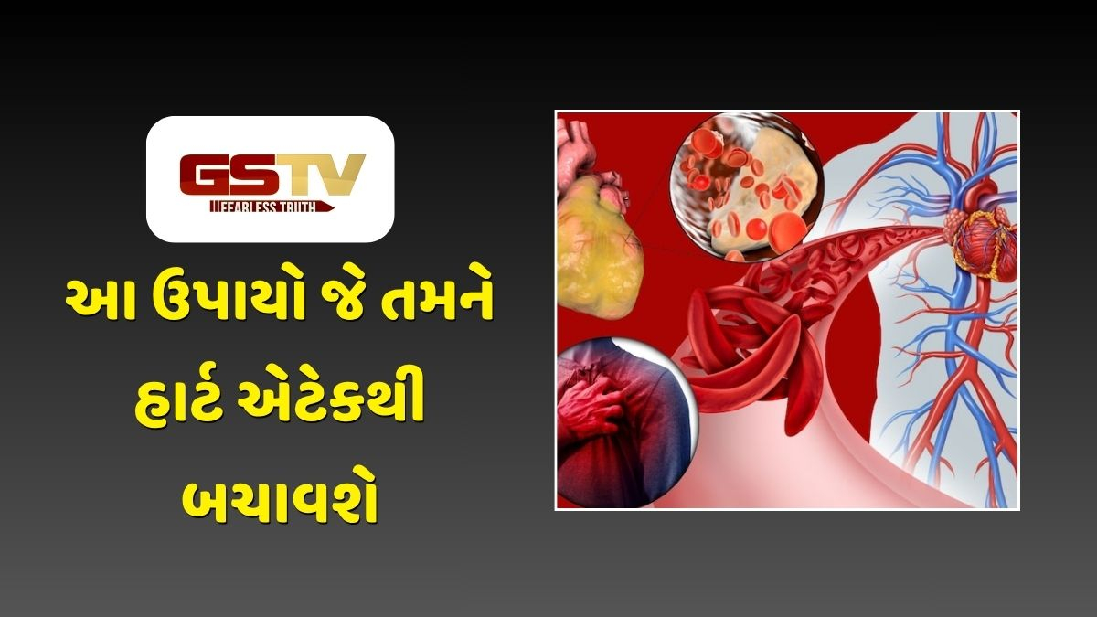 Health Tips : ખરાબ આહાર બની શકે છે હાર્ટ બ્લોકેજનું કારણ, જાણો હૃદયને સ્વસ્થ રાખવા માટેની ટિપ્સ