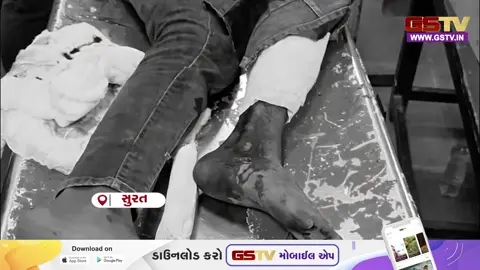 VIDEO: સુરતના લીંબાયત વિસ્તારમાં પોલીસ અને આરોપી વચ્ચે અથડામણ, એક પોલીસકર્મી ઈજાગ્રસ્ત