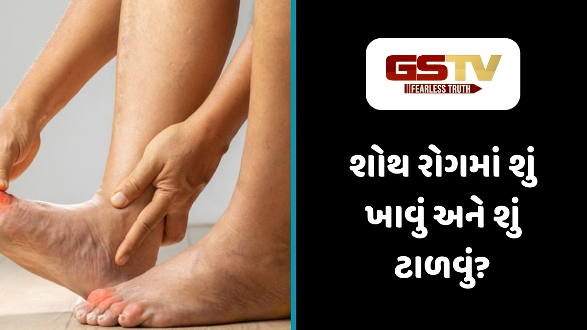 Sahiyar : શરીરમાં સોજો કેમ આવે છે? જાણો ‘શોથ રોગ’ના પ્રકાર, લક્ષણો અને આયુર્વેદિક ઉપચાર