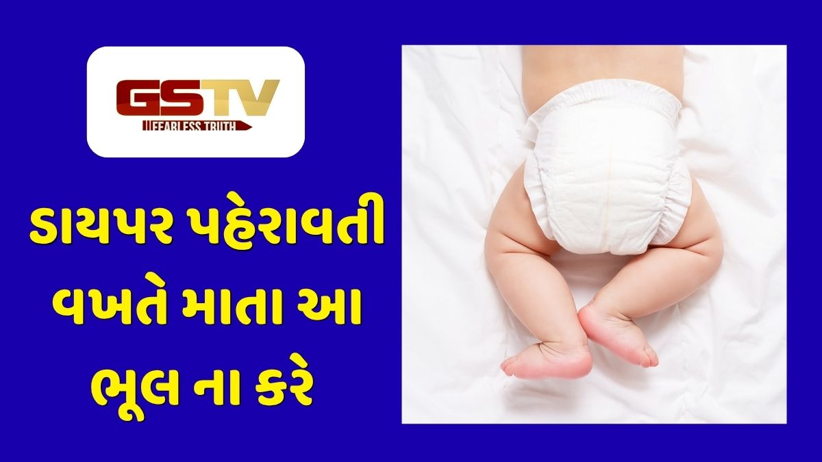 Parenting Tips: નાજુક ત્વચાની ખાસ કાળજી: જો બાળકને ડાયપર પહેરાવતા હોવ તો જરૂર જાણો આ ટિપ્સ