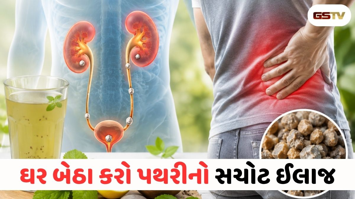 Health News : ઓપરેશન વગર કિડનીની પથરીથી મેળવો છુટકારો! આ સરળ ઉપાય પથરીને આપોઆપ ઓગાળી દેશે