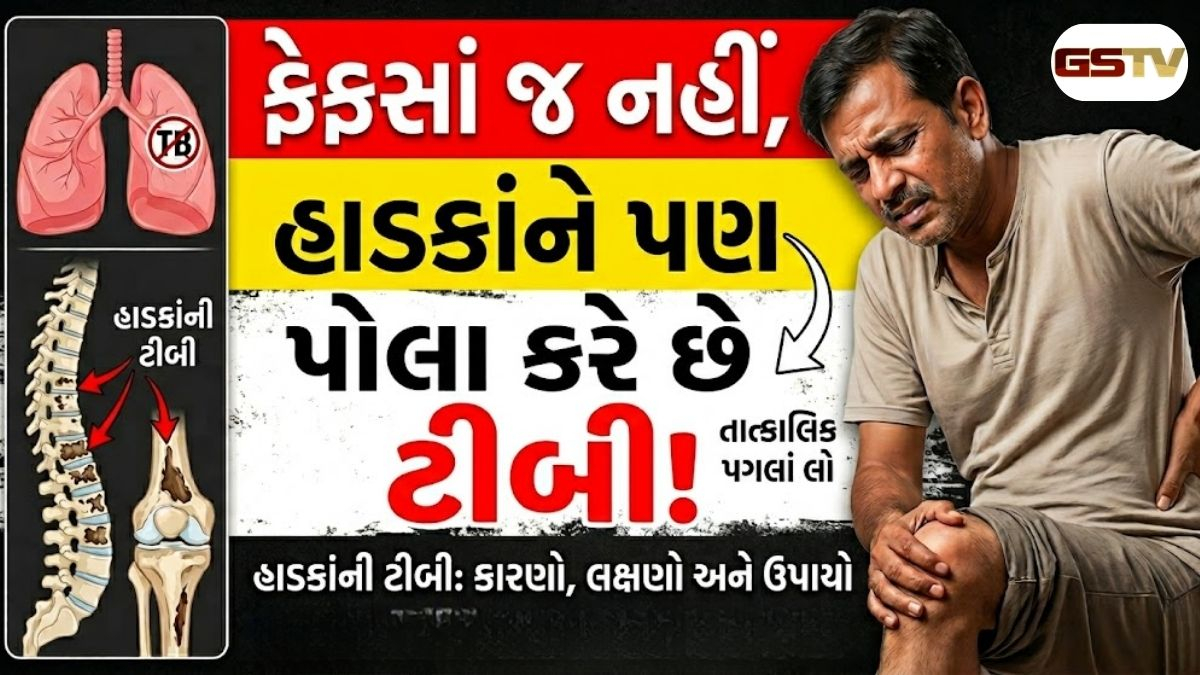 Health News : ગંભીર બની શકે છે હાડકાનો ટીબી: ક્યારે થાય છે આ રોગ અને કેવી રીતે કરશો બચાવ?