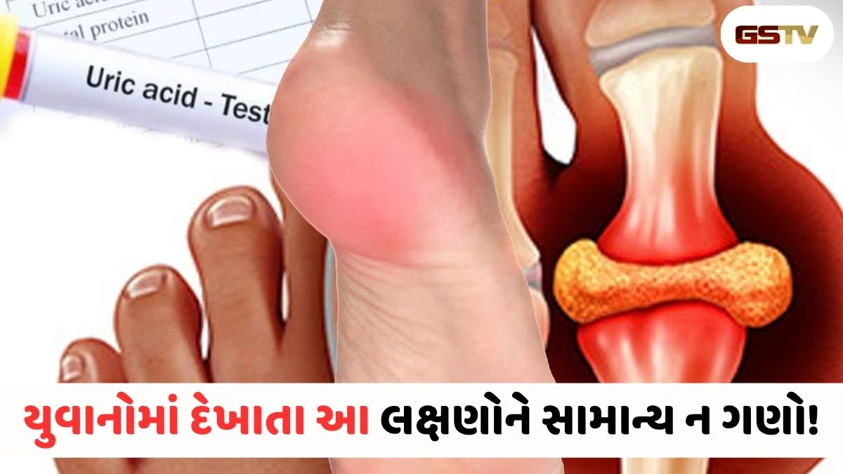 VIDEO : યુવાનો કેમ બની રહ્યા છે યુરિક એસિડનો ભોગ? આ શરૂઆતી લક્ષણોને ક્યારેય ન અવગણો