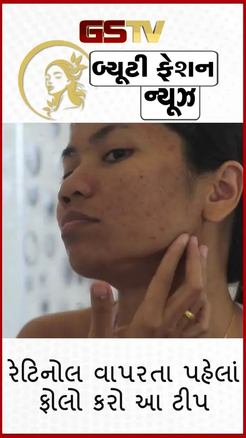 VIDEO: Beauty Tips/ જો રેટિનોલ વાપરતા પહેલાં આ નાની ટીપ ફોલો નહીં કરો, તો ગ્લો આવવાના બદલે ચહેરા પર થવા લાગશે અસહ્ય બળતરા!