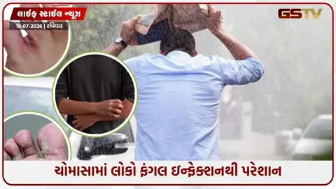 VIDEO: ચોમાસું આવતા જ કેમ ફાટી નીકળે છે ફંગલ ઇન્ફેક્શન? જાણો ફૂગનો ચેપ પાછળના મુખ્ય કારણો