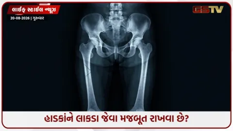 VIDEO: કેલ્શિયમ ખાવા છતાં હાડકાં કેમ પોલા થાય છે? આ ઝેર સમાન વસ્તુઓ છે જવાબદાર!