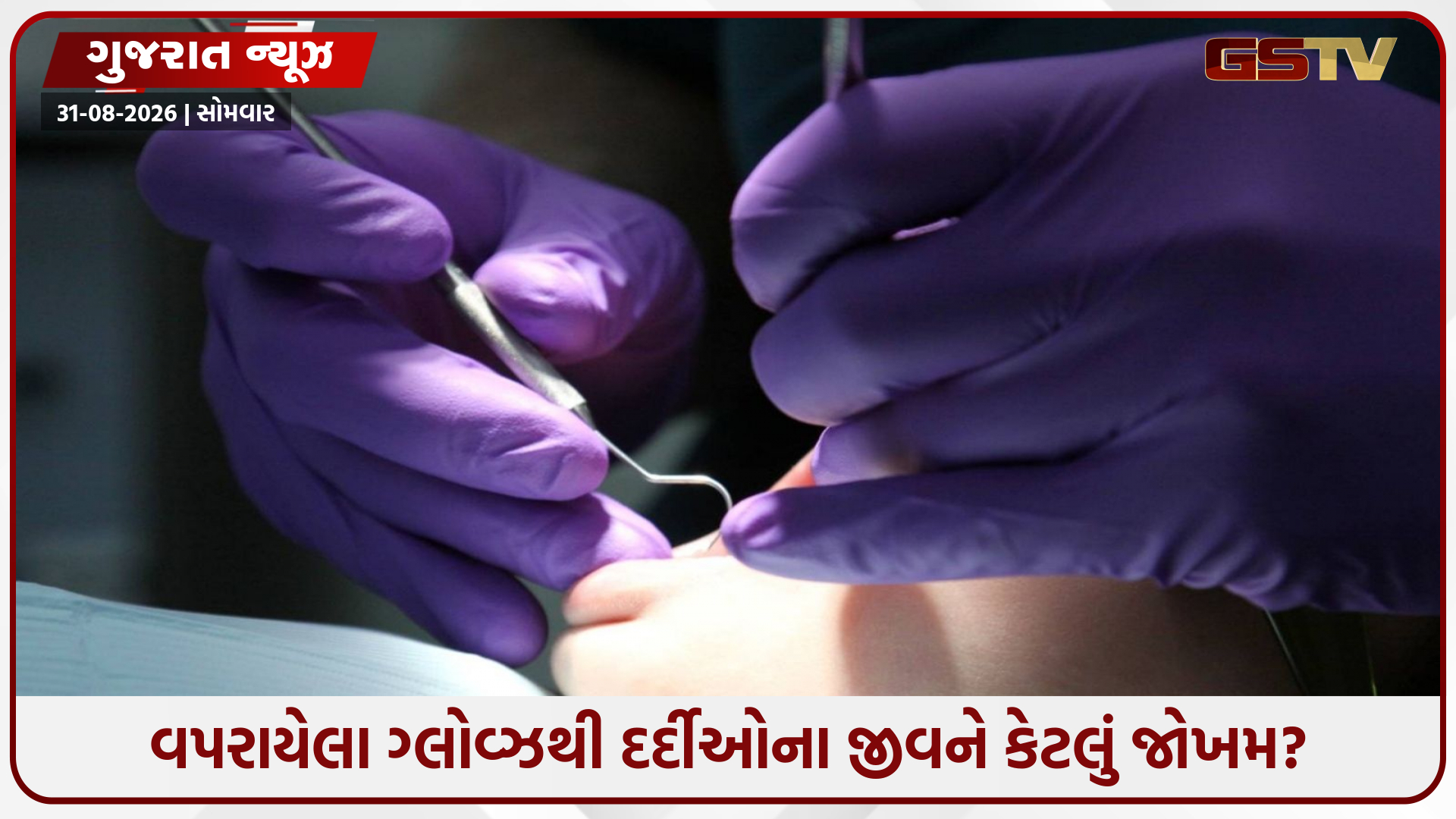 અમદાવાદ સિવિલમાં સર્જિકલ ગ્લોવ્ઝ ખૂટી પડ્યા, આરોગ્ય વ્યવસ્થાની લાલિયાવાડી સામે મોટો સવાલ