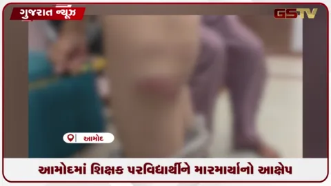 VIDEO: ભરૂચના આમોદમાં ધોરણ-૨ના માસૂમ વિદ્યાર્થીને શિક્ષકે પાઇપથી માર મારતાં ચકચાર